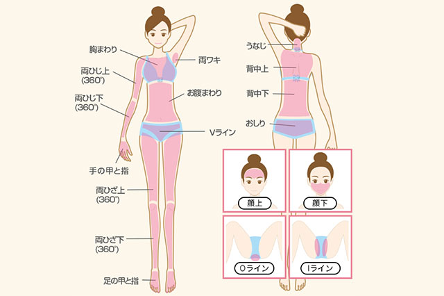 リンリン全身脱毛